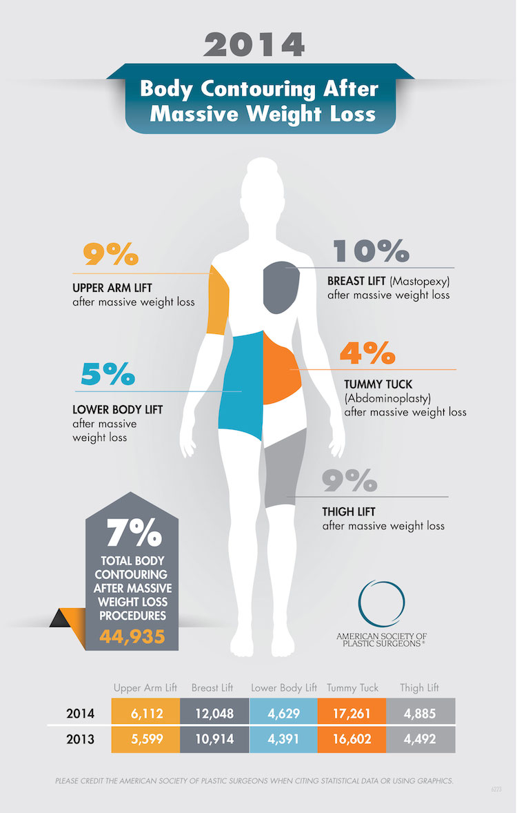 Plastic surgery infographic image - Search Influence 